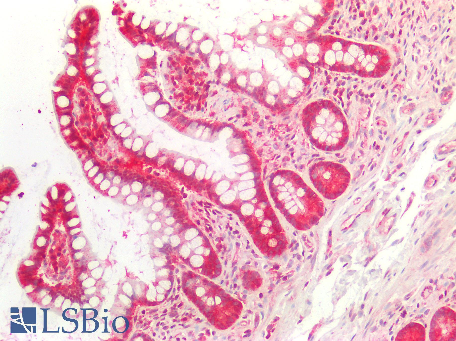 EXT1 Antibody - Human Small Intestine: Formalin-Fixed, Paraffin-Embedded (FFPE)