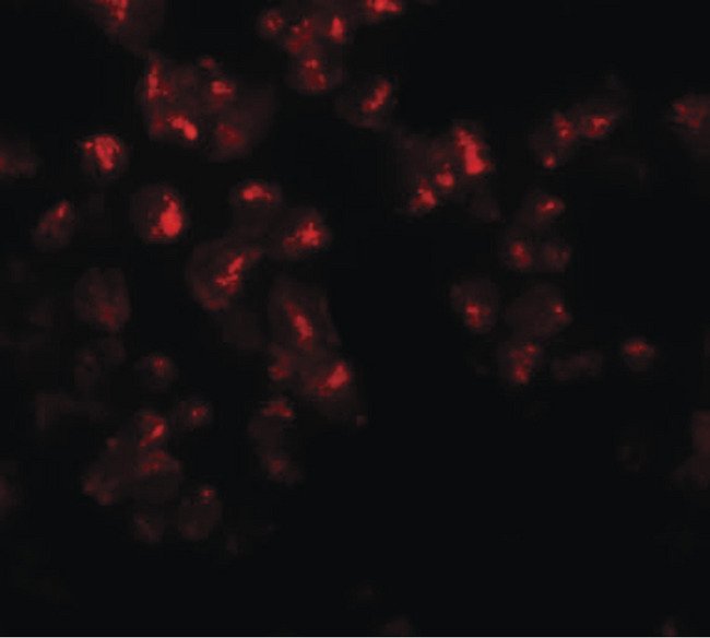 EZH2 Antibody - Immunofluorescence of EZH2 in 293 cells with EZH2 antibody at 20 ug/ml.