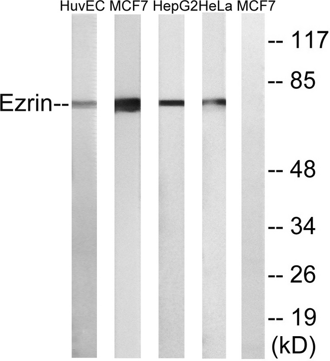 EZR / Ezrin Antibody - Western blot analysis of lysates from HuvE, MCF-7, HepG2, and HeLa cells, using Ezrin Antibody. The lane on the right is blocked with the synthesized peptide.