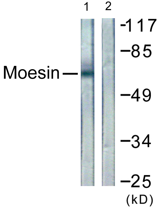 Ezrin + Radixin + Moesin Antibody - Western blot analysis of lysates from NIH/3T3 cells, using Moesin/Ezrin/Radixin Antibody. The lane on the right is blocked with the synthesized peptide.