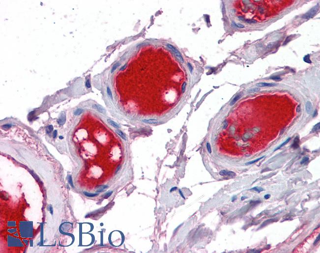 F10 / Factor X Antibody - Anti-F10 / Factor X antibody IHC of human small intestine, vessels. Immunohistochemistry of formalin-fixed, paraffin-embedded tissue after heat-induced antigen retrieval. Antibody concentration 5 ug/ml.
