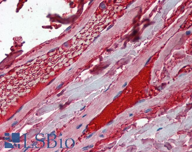 F10 / Factor X Antibody - Anti-F10 / Factor X antibody IHC staining of human vessels. Immunohistochemistry of formalin-fixed, paraffin-embedded tissue after heat-induced antigen retrieval. Antibody concentration 5 ug/ml.