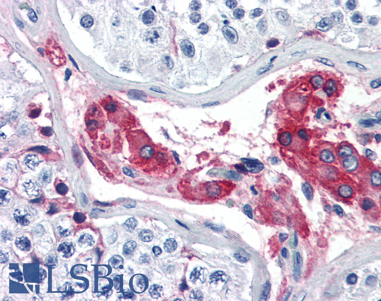 F12 / Factor XII Antibody - Anti-F12 / Factor XII antibody IHC of human testis. Immunohistochemistry of formalin-fixed, paraffin-embedded tissue after heat-induced antigen retrieval. Antibody concentration 5 ug/ml.