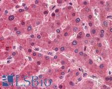 F12 / Factor XII Antibody - Anti-F12 / Factor XII antibody IHC of human liver. Immunohistochemistry of formalin-fixed, paraffin-embedded tissue after heat-induced antigen retrieval. Antibody concentration 5 ug/ml.