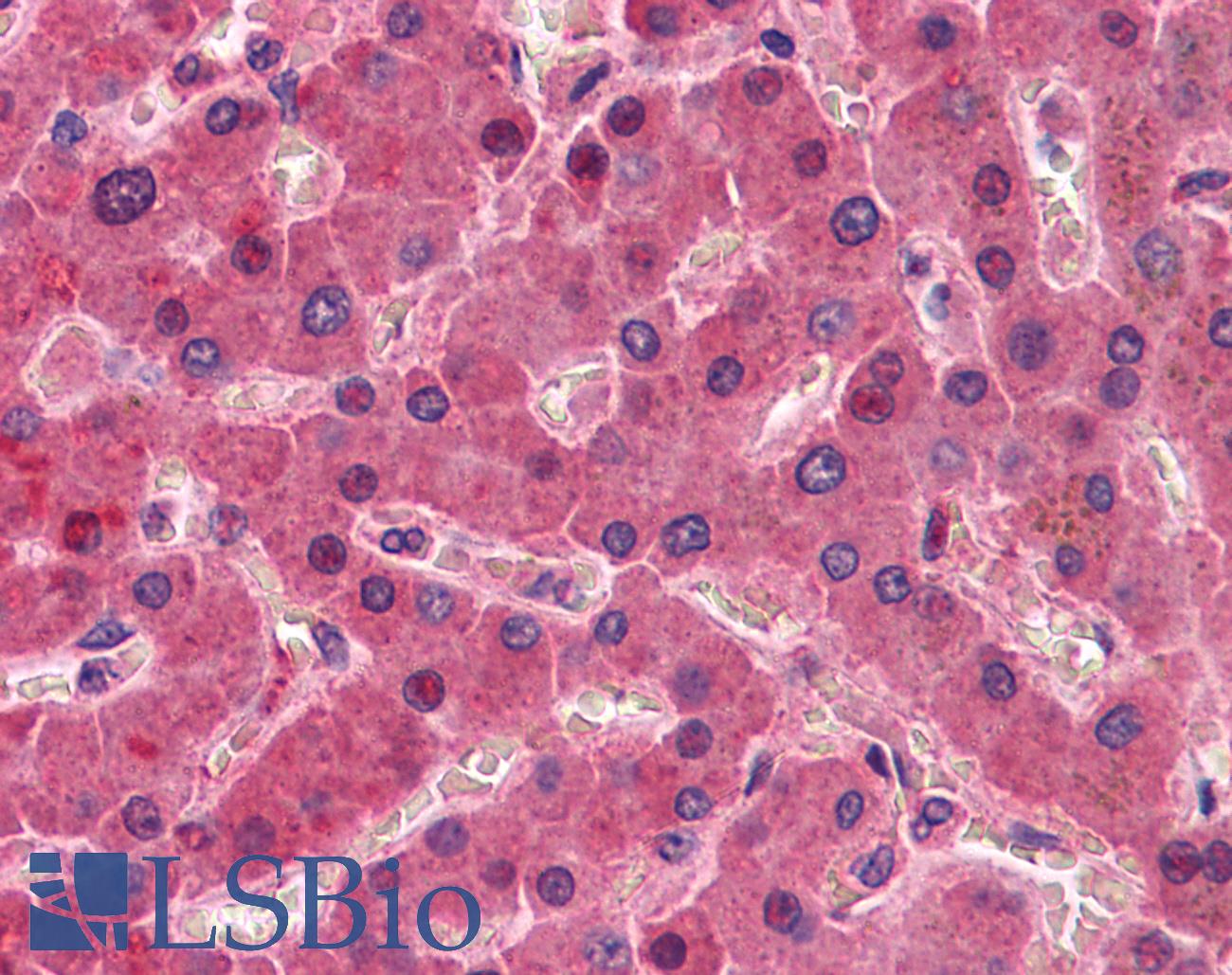 F12 / Factor XII Antibody - Anti-F12 / Factor XII antibody IHC of human liver. Immunohistochemistry of formalin-fixed, paraffin-embedded tissue after heat-induced antigen retrieval. Antibody concentration 5 ug/ml.