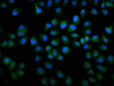 F13A1 / Factor XIIIa Antibody - Immunofluorescence staining of Hela cells with F13A1 Antibody at 1:166, counter-stained with DAPI. The cells were fixed in 4% formaldehyde, permeabilized using 0.2% Triton X-100 and blocked in 10% normal Goat Serum. The cells were then incubated with the antibody overnight at 4°C. The secondary antibody was Alexa Fluor 488-congugated AffiniPure Goat Anti-Rabbit IgG(H+L).