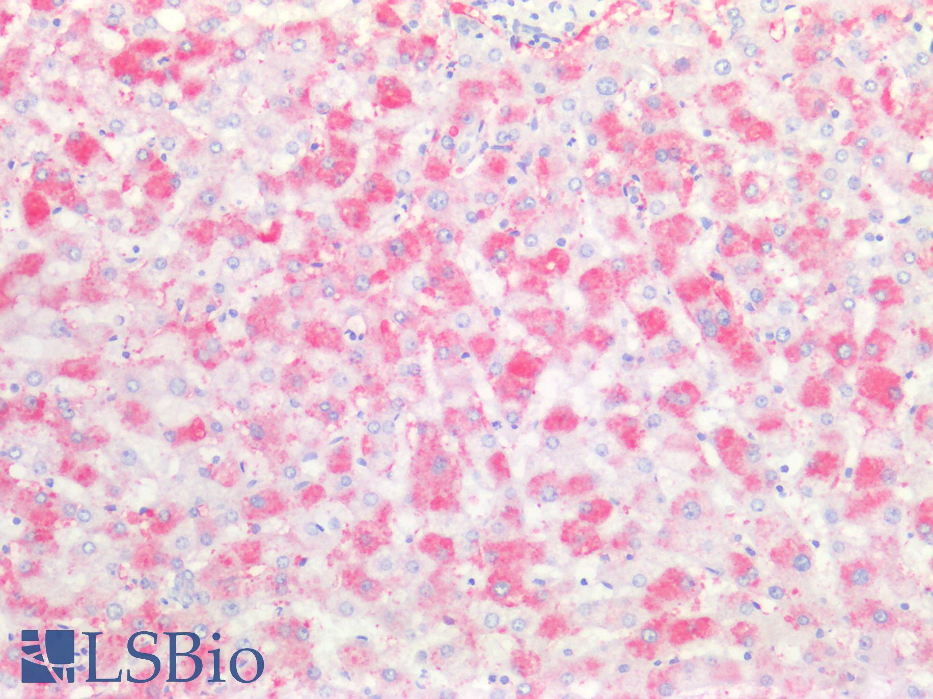 F13A1 / Factor XIIIa Antibody - Human Liver: Formalin-Fixed, Paraffin-Embedded (FFPE)