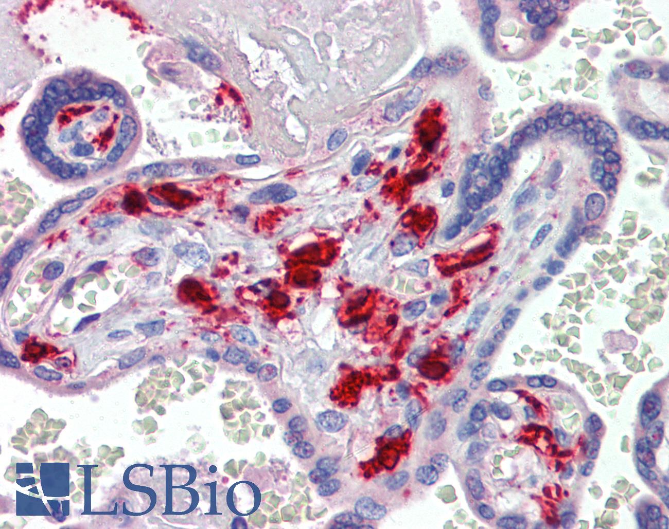 F13A1 / Factor XIIIa Antibody - Anti-F13A1 / Factor XIIIa antibody IHC of human placenta. Immunohistochemistry of formalin-fixed, paraffin-embedded tissue after heat-induced antigen retrieval. Antibody concentration 3 ug/ml.