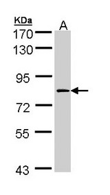 F13A1 / Factor XIIIa Antibody - Sample (30 ug of whole cell lysate). A: H1299. 7.5 % SDS PAGE. F13A1 / Factor XIIIa antibody diluted at 1:1000