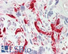 F13A1 / Factor XIIIa Antibody - Human Placenta: Formalin-Fixed, Paraffin-Embedded (FFPE)