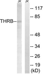 F2 / Prothrombin / Thrombin Antibody - Western blot of extracts from Jurkat cells, treated with etoposide 25 uM 24H, using THRB (AP2, Cleaved-Arg327) Antibody. The lane on the right is treated with the synthesized peptide.