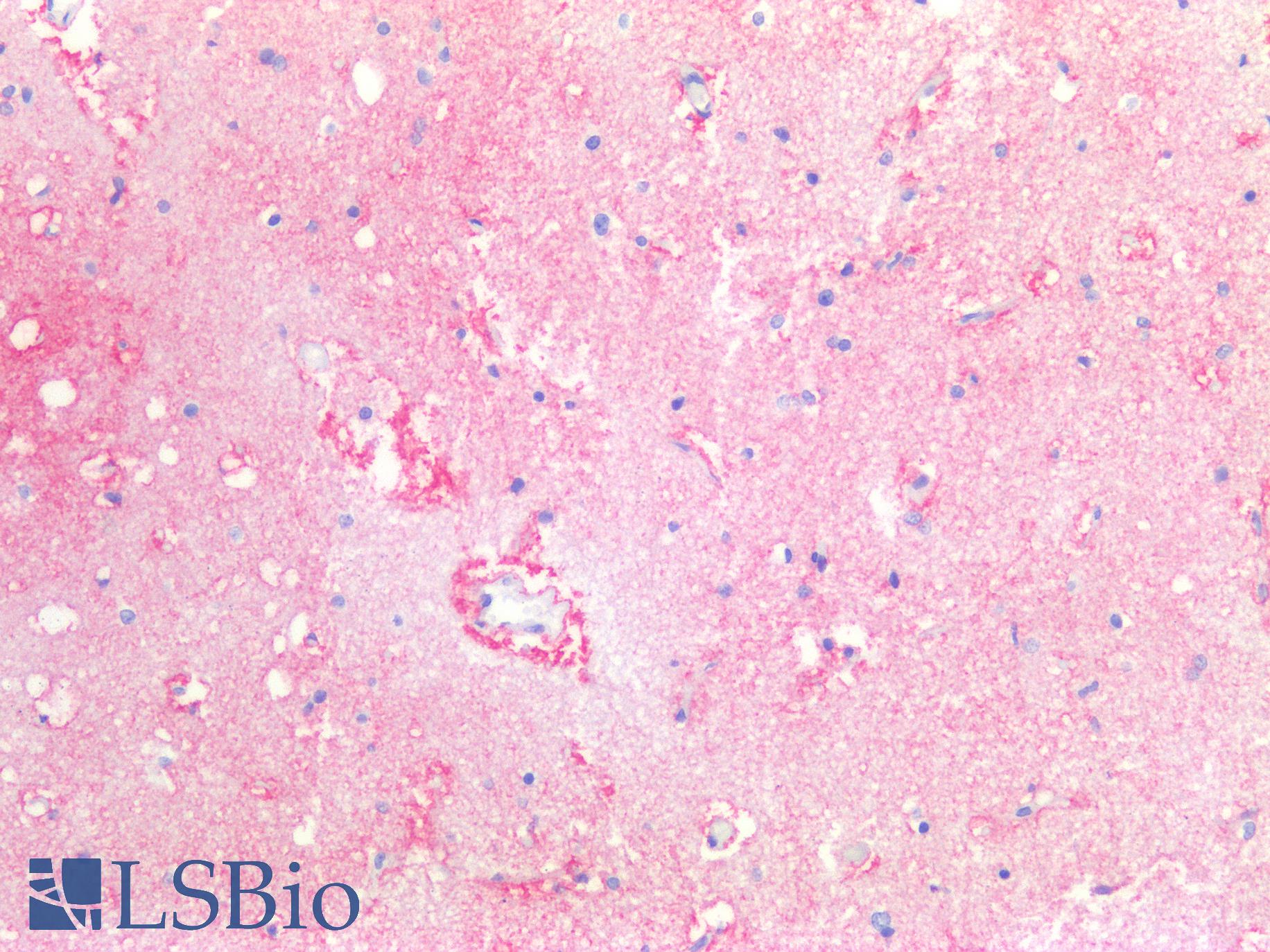 F3 / CD142 / Tissue factor Antibody - Human Brain, Cortex: Formalin-Fixed, Paraffin-Embedded (FFPE)