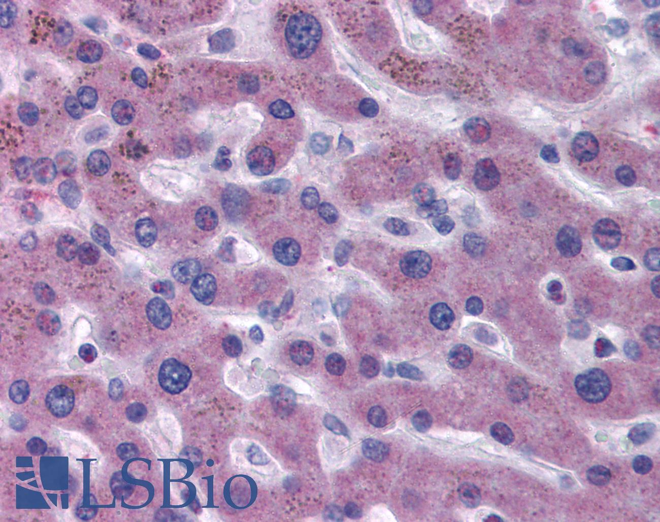 F7 / Factor VII Antibody - Anti-F7 / Factor VII antibody IHC of human liver. Immunohistochemistry of formalin-fixed, paraffin-embedded tissue after heat-induced antigen retrieval. Antibody concentration 5 ug/ml.