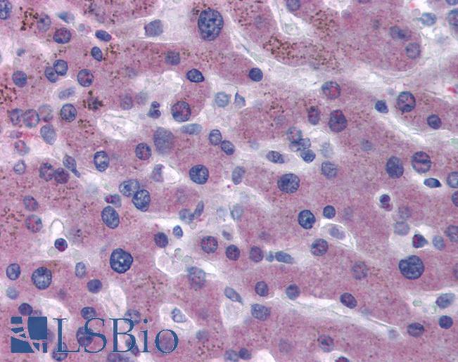 F7 / Factor VII Antibody - Anti-F7 / Factor VII antibody IHC of human liver. Immunohistochemistry of formalin-fixed, paraffin-embedded tissue after heat-induced antigen retrieval. Antibody concentration 5 ug/ml.