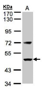 F7 / Factor VII Antibody - Sample(30 g of whole cell lysate). A: H1299. 7.5% SDS PAGE. F7 antibody diluted at 1:500.