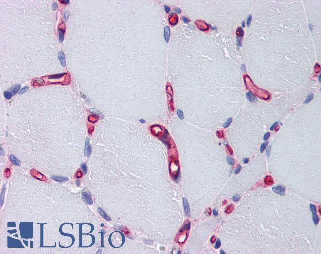 F8 / FVIII / Factor VIII Antibody - Anti-F8 / Factor VIII antibody IHC of human skeletal muscle and capillaries. Immunohistochemistry of formalin-fixed, paraffin-embedded tissue after heat-induced antigen retrieval. Antibody concentration 5 ug/ml.