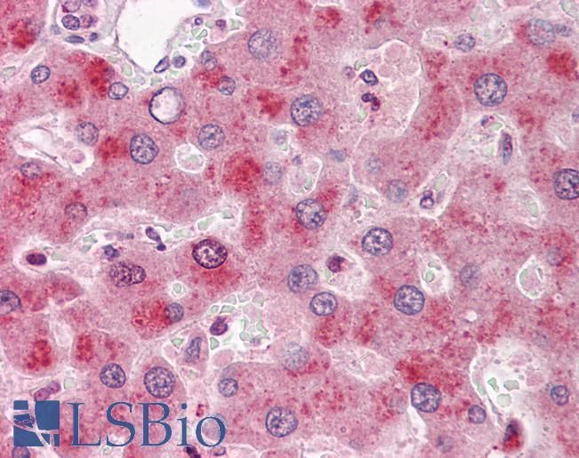 F9 / Factor IX Antibody - Anti-F9 / Factor IX antibody IHC of human liver. Immunohistochemistry of formalin-fixed, paraffin-embedded tissue after heat-induced antigen retrieval. Antibody concentration 10 ug/ml.