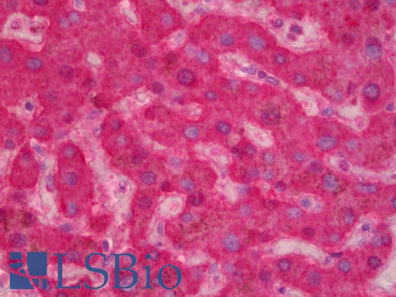 F9 / Factor IX Antibody - Anti-F9 / Factor IX antibody IHC of human liver. Immunohistochemistry of formalin-fixed, paraffin-embedded tissue after heat-induced antigen retrieval. Antibody concentration 2.5 ug/ml.