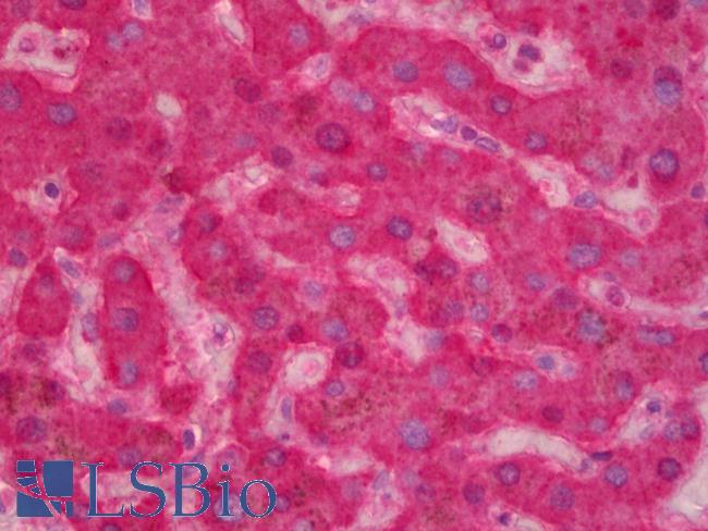 F9 / Factor IX Antibody - Anti-F9 / Factor IX antibody IHC of human liver. Immunohistochemistry of formalin-fixed, paraffin-embedded tissue after heat-induced antigen retrieval. Antibody concentration 2.5 ug/ml.