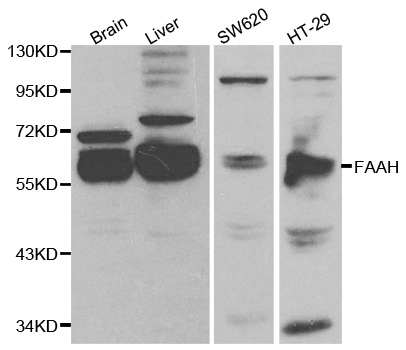FAAH Antibody - Western blot analysis of extracts of various cell lines, using FAAH antibody at 1:1000 dilution. The secondary antibody used was an HRP Goat Anti-Rabbit IgG (H+L) at 1:10000 dilution. Lysates were loaded 25ug per lane and 3% nonfat dry milk in TBST was used for blocking.