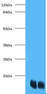 FABP1 / L-FABP Antibody - Western blot of Fatty acid-binding protein, liver antibody at 2 ug/ml. Lane1: Recombinant Fatty acid-binding protein, liver protein 10ng. Lane 2: Recombinant Fatty acid-binding protein, liver protein 100ng.  This image was taken for the unconjugated form of this product. Other forms have not been tested.