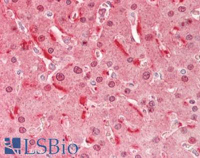 FABP1 / L-FABP Antibody - Human Liver: Formalin-Fixed, Paraffin-Embedded (FFPE).  This image was taken for the unconjugated form of this product. Other forms have not been tested.