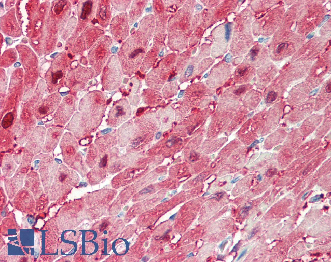 FABP3 / H-FABP Antibody - Anti-FABP3 / H-FABP antibody IHC staining of human heart. Immunohistochemistry of formalin-fixed, paraffin-embedded tissue after heat-induced antigen retrieval. Antibody concentration 5 ug/ml.