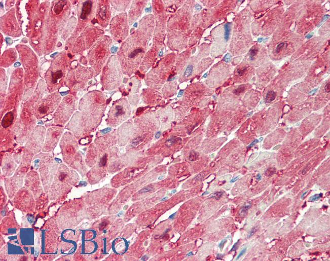 FABP3 / H-FABP Antibody - Anti-FABP3 / H-FABP antibody IHC staining of human heart. Immunohistochemistry of formalin-fixed, paraffin-embedded tissue after heat-induced antigen retrieval. Antibody concentration 5 ug/ml.