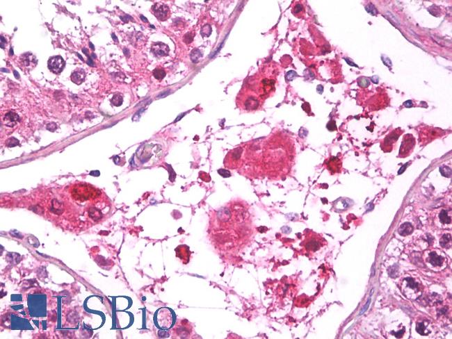 FABP3 / H-FABP Antibody - Anti-FABP3 / H-FABP antibody IHC of human testis, Leydig cells. Immunohistochemistry of formalin-fixed, paraffin-embedded tissue after heat-induced antigen retrieval. Antibody dilution 1:50.