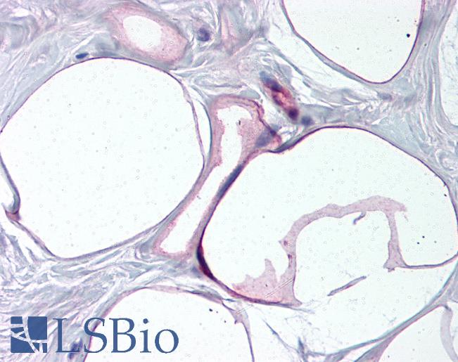 FABP4 / AP2 Antibody - Anti-FABP4 antibody IHC of human breast, adipocytes. Immunohistochemistry of formalin-fixed, paraffin-embedded tissue after heat-induced antigen retrieval. Antibody concentration 10 ug/ml.