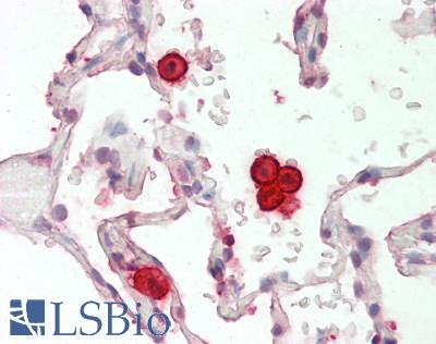 FABP4 / AP2 Antibody - Human Lung: Formalin-Fixed, Paraffin-Embedded (FFPE)