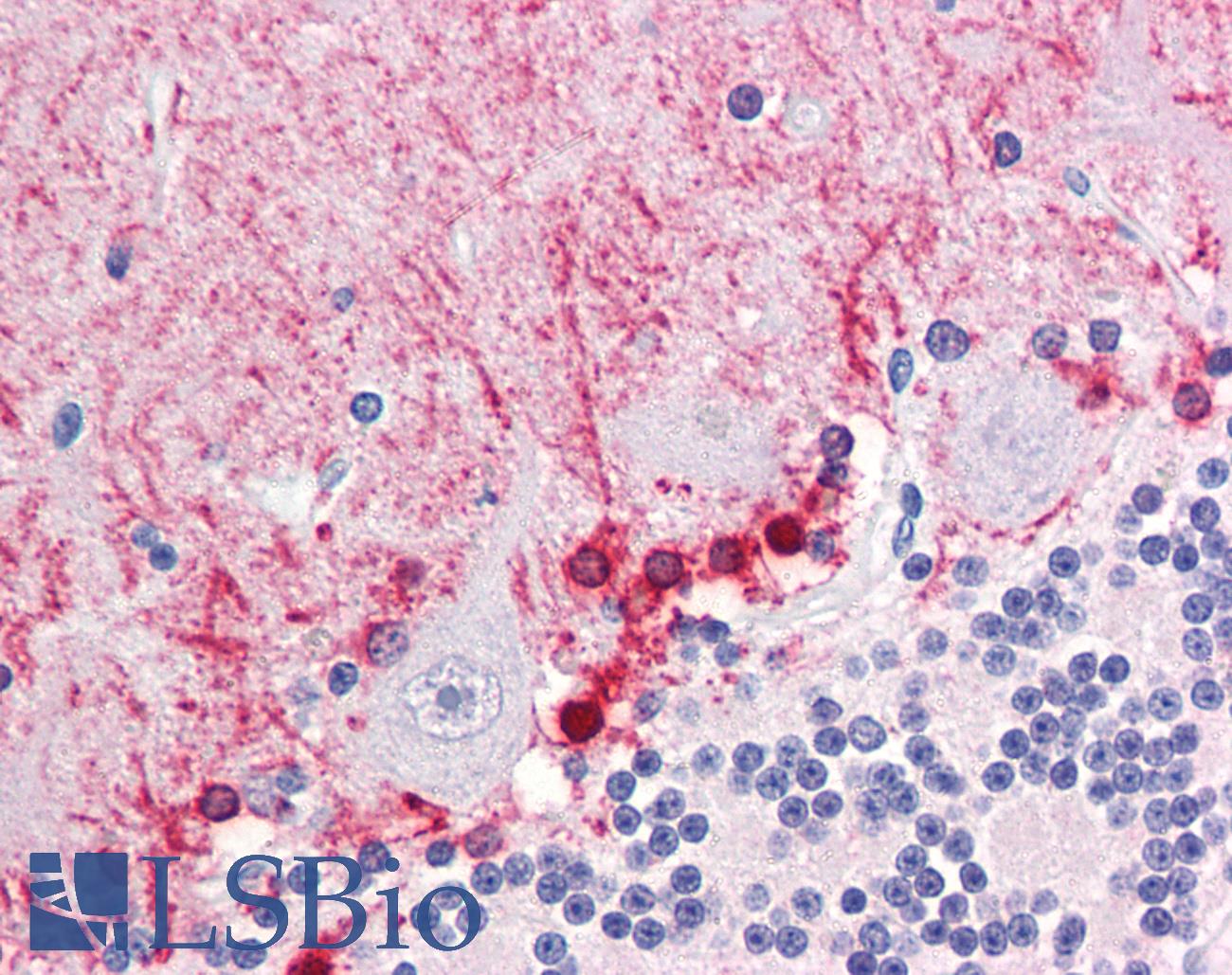 FABP7 / BLBP / MRG Antibody - Anti-FABP7 / BLBP antibody IHC of human brain, cerebellum. Immunohistochemistry of formalin-fixed, paraffin-embedded tissue after heat-induced antigen retrieval. Antibody concentration 5 ug/ml.