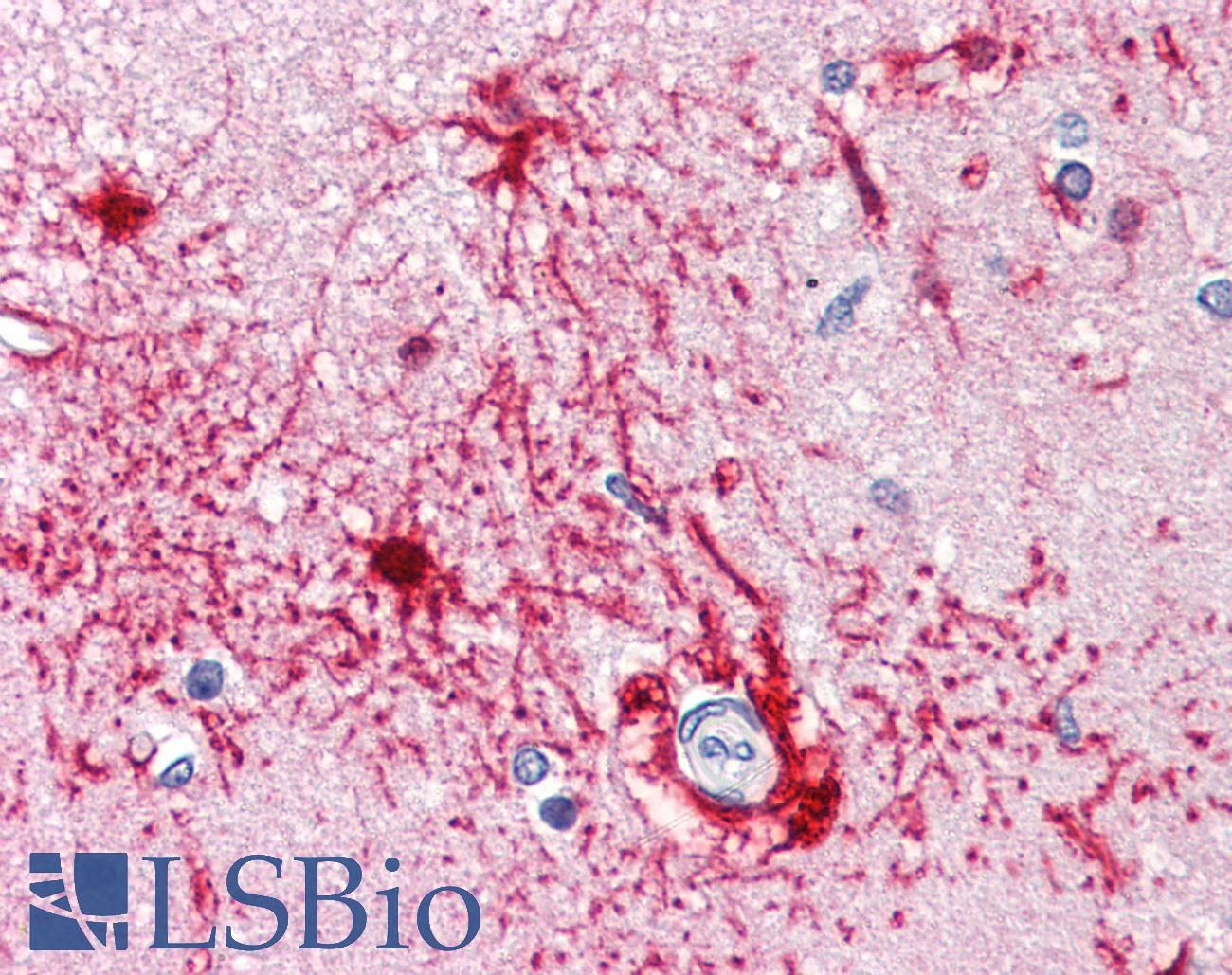FABP7 / BLBP / MRG Antibody - Anti-FABP7 / BLBP antibody IHC of human brain, cortex. Immunohistochemistry of formalin-fixed, paraffin-embedded tissue after heat-induced antigen retrieval. Antibody concentration 5 ug/ml.