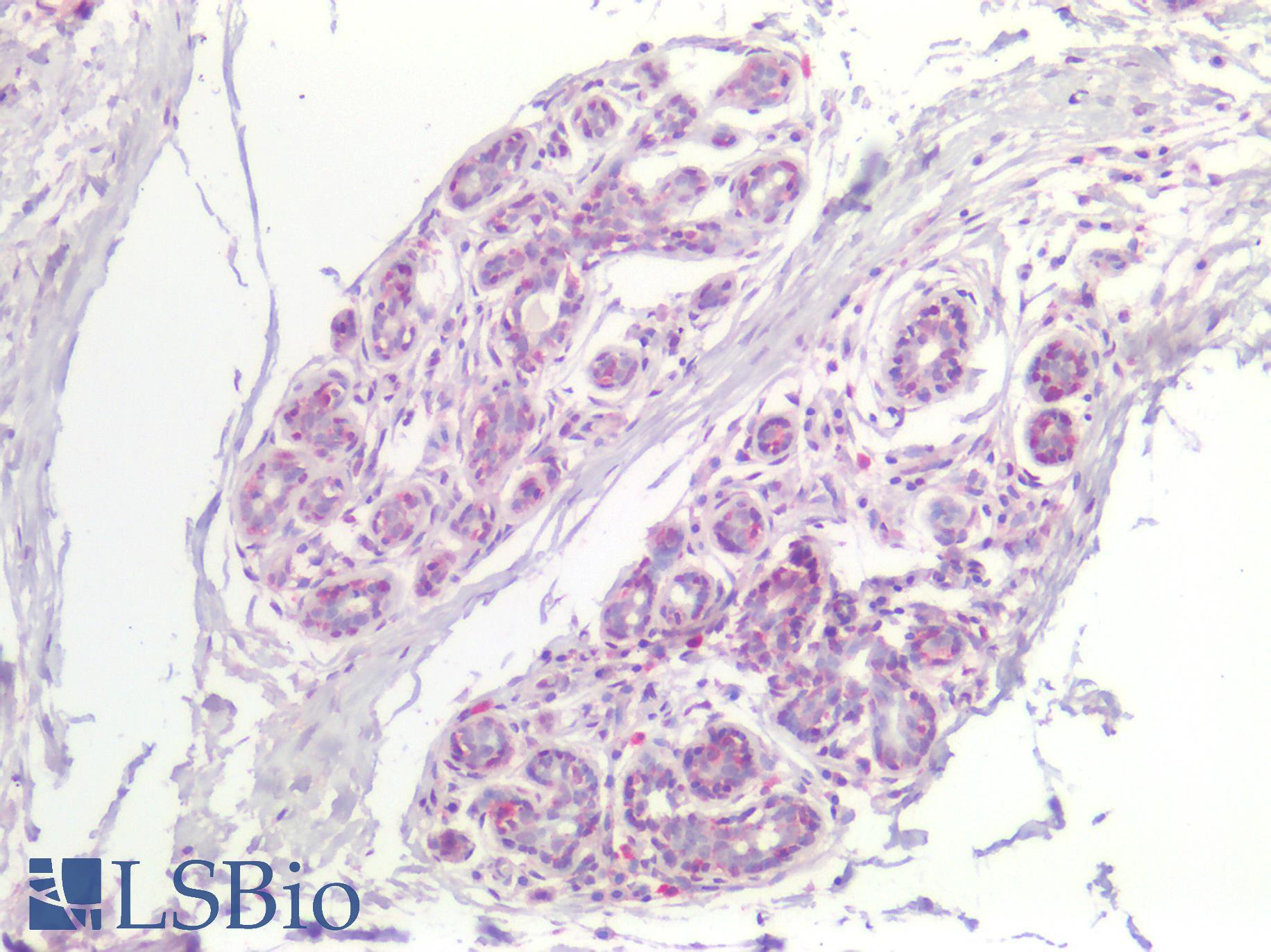 FABP7 / BLBP / MRG Antibody - Human Breast: Formalin-Fixed, Paraffin-Embedded (FFPE)