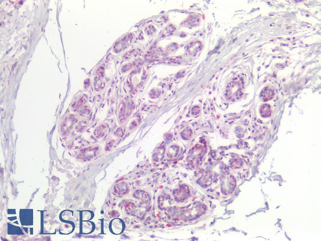 FABP7 / BLBP / MRG Antibody - Human Breast: Formalin-Fixed, Paraffin-Embedded (FFPE)