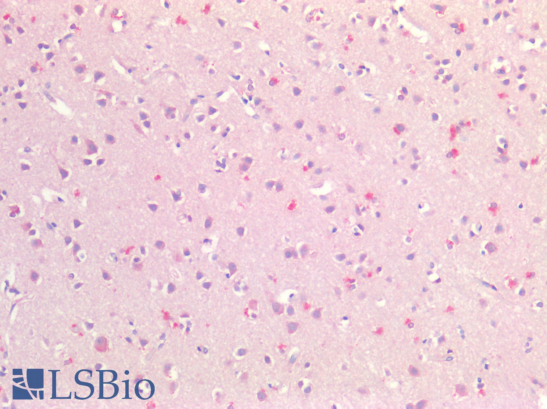 FABP7 / BLBP / MRG Antibody - Human Brain, Cortex: Formalin-Fixed, Paraffin-Embedded (FFPE)