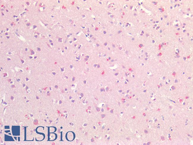 FABP7 / BLBP / MRG Antibody - Human Brain, Cortex: Formalin-Fixed, Paraffin-Embedded (FFPE)