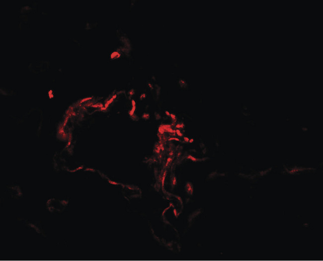 FACL2 / ACSL1 Antibody - Immunofluorescence of ASCL1 in human lung tissue with ASCL1 antibody at 20 ug/ml.