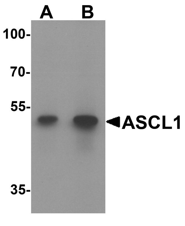 FACL2 / ACSL1 Antibody - Western blot analysis of ACSL1 in human lung tissue lysate with ACSL1 antibody at (A) 1 and (B) 2 ug/ml.