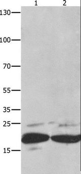 FADD Antibody - Western blot analysis of Mouse spleen tissue and RAW264.7 cell, using FADD Polyclonal Antibody at dilution of 1:550.