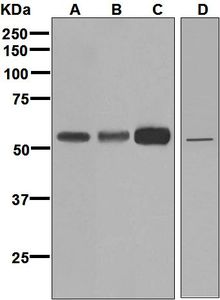 FADS1 Antibody - Western blot analysis on (A) fetal lung, (B) fetal liver, (C) fetal brain, and (D) HepG2 lysates using anti-FADS1 antibody.