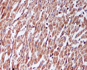 FADS1 Antibody - IHC of paraffin-embedded human heart tissue using anti-FADS1 antibody.