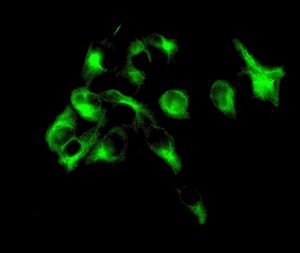 FADS1 Antibody - Immunofluorescent staining of A549 cells using anti-FADS1 antibody.