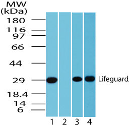 FAIM2 / LIFEGUARD Antibody - Western blot of human Lifeguard in human brain lysate in the 1)?absence and 2) presence of immunizing peptide using antibody at 2 ug/ml, 3) mouse?brain lysate?at 1 ug/ml and 4) rat brain lysate at 0.5 ug/ml.