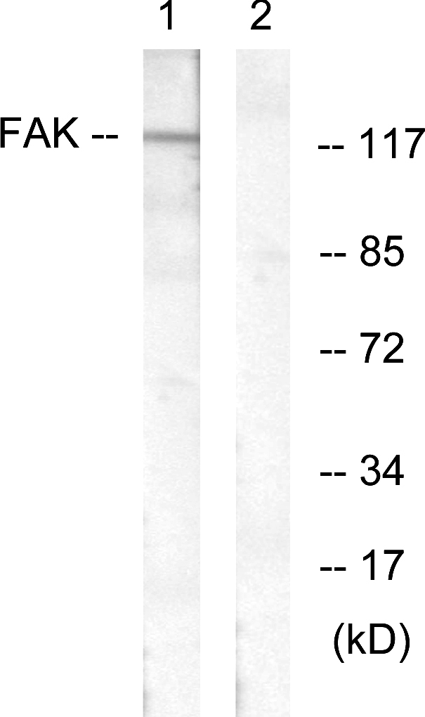 FAK / Focal Adhesion Kinase Antibody - Western blot analysis of lysates from HeLa cells, treated with EGF 200ng/ml 30', using FAK Antibody. The lane on the right is blocked with the synthesized peptide.