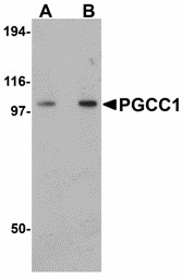 FAM120B Antibody - Western blot of PGCC1 in rat thymus tissue lysate with PGCC1 antibody at (A) 0.5 and (B) 1 ug/ml.