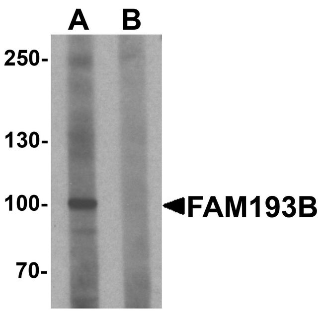 FAM193B Antibody - Western blot analysis of FAM193B in Jurkat cell lysate with FAM193B antibody at 1 ug/ml in (A) the absence and (B) the presence of blocking peptide.