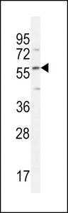 FAM20C Antibody - DMP4 Antibody western blot of HepG2 cell line lysates (35 ug/lane). The DMP4 antibody detected the DMP4 protein (arrow).