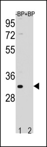 FAM26F Antibody - Western blot of FAM26F Antibody antibody pre-incubated without(lane 1) and with(lane 2) blocking peptide in NCI-H460 cell line lysate. FAM26F Antibody (arrow) was detected using the purified antibody.