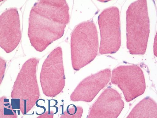 FAM40A Antibody - Anti-FAM40A antibody IHC staining of human skeletal muscle. Immunohistochemistry of formalin-fixed, paraffin-embedded tissue after heat-induced antigen retrieval. Antibody dilution 1:100.